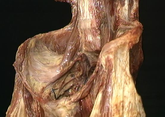 Reactive Training with Core-Tex for Mobility?  Yes.  And here is how and why.